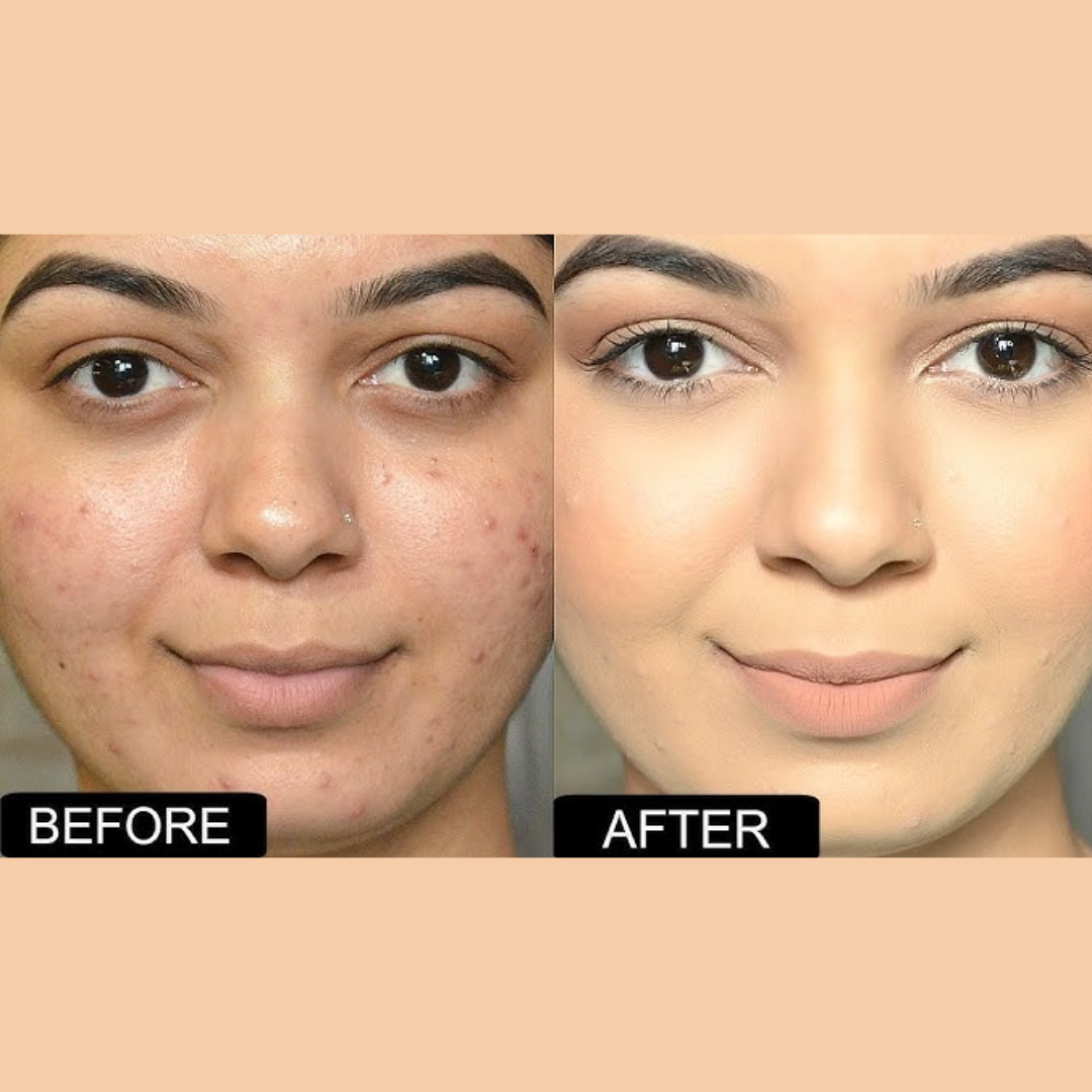 Chanel Ultra Glowy Foundation - Waterproof & Best Coverage