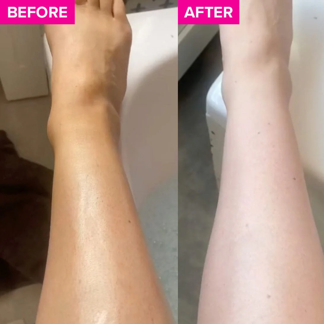 Skarfix-Plus Brightening Body Wash | 4% actives to cleanse, brighten, and fade dark spots - Instant DeTan Solution