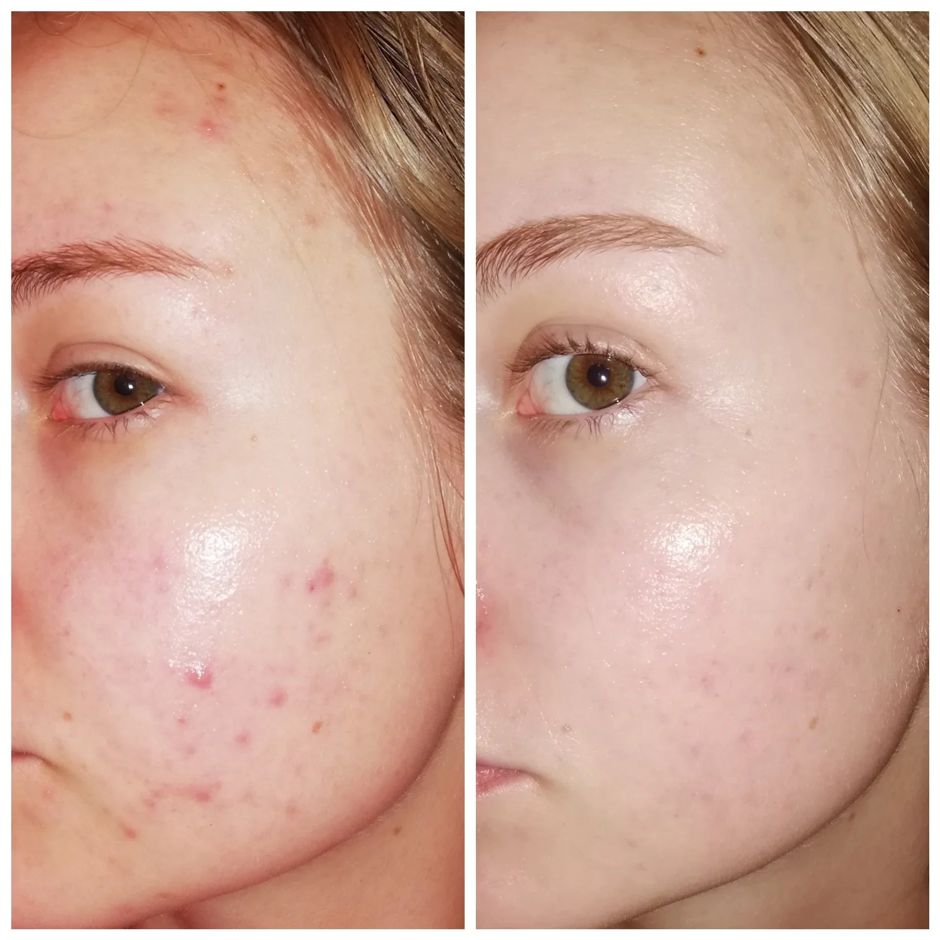 Deconstruct Clearing Serum - Remove Pigmentation & dark spots in just 7 days - Guaranteed Results